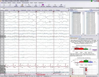 komparative Analyse komparative Analyse
