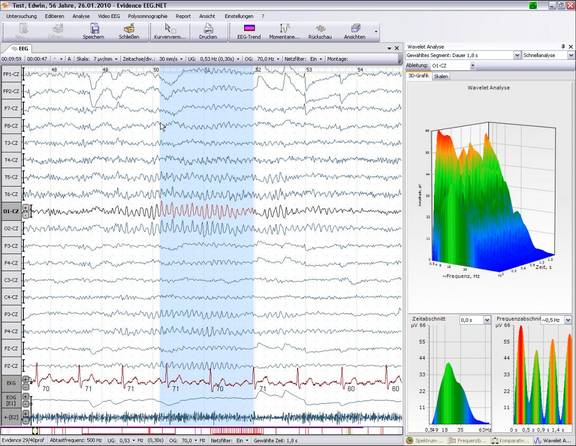 Wavelet Analyse