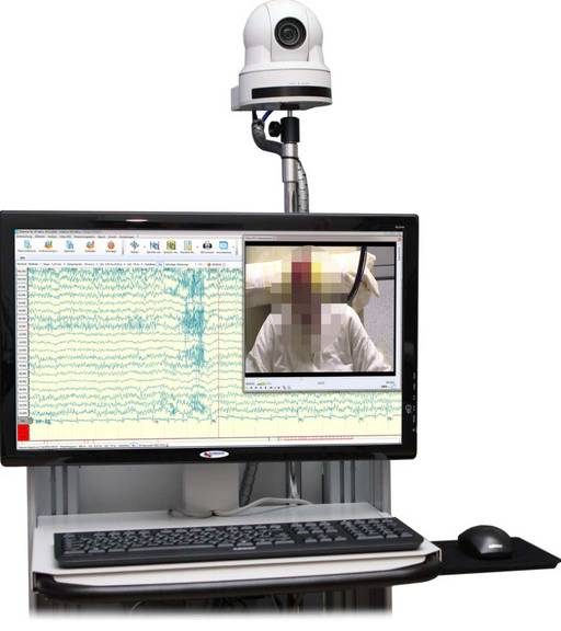 Video EEG video eeg